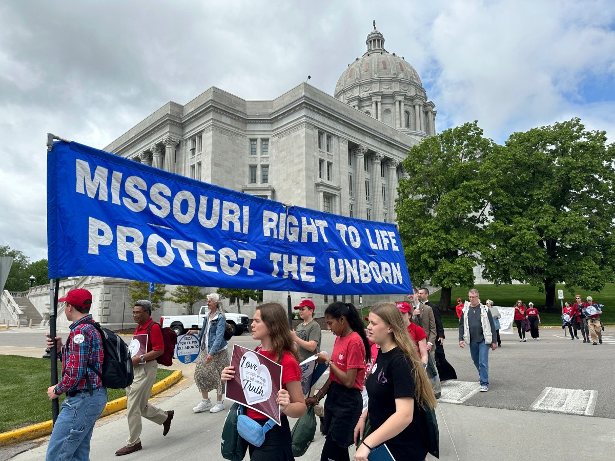 Burlison says Missouri abortion vote is more important than any political race